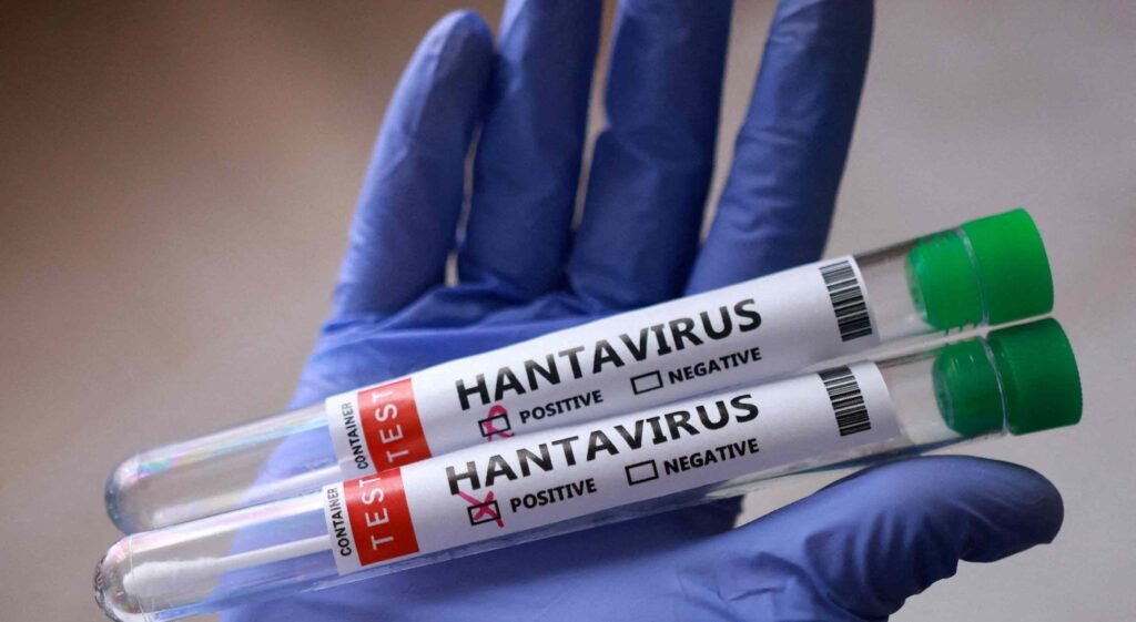 Surto de hantavírus na França leva 22 pessoas à hospitalização após contato com passageira