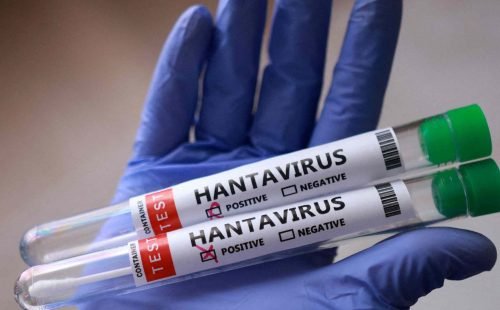 Surto de hantavírus na França leva 22 pessoas à hospitalização após contato com passageira