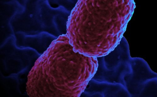 klebsiella_pneumoniae_bacterium_colorized_scanning_electron_micrograph_showing_carbapenem-resistant.jpeg